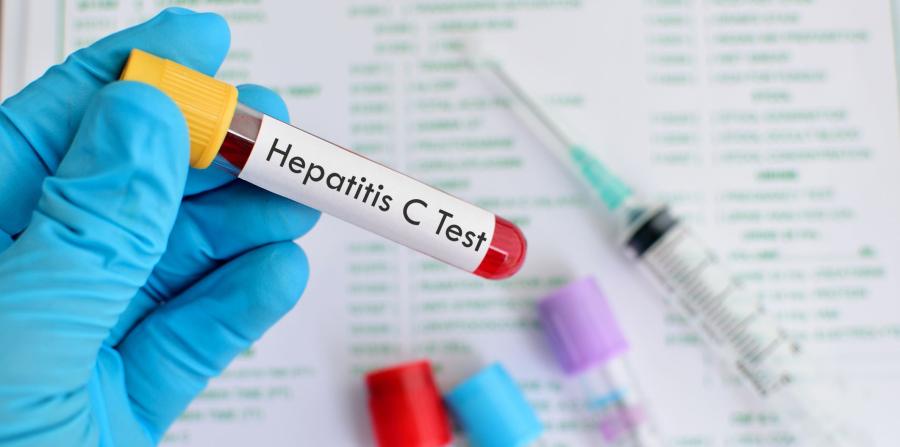 Epidemia silenciosa provocada por la Hepatitis C